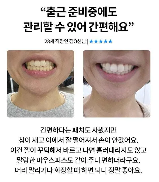 Ister14 D Intensive Whitening Gel